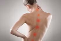 Cong vẹo cột sống và những hậu quả nghiêm trọng