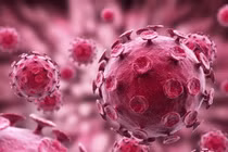 Hôn người lạ ở quán bar, nam thanh niên mắc sùi mào gà ở chân răng