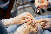 Đánh cược sức khỏe, tính mạng chạy theo cái đẹp