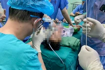 Bé trai 34 tháng tuổi viêm phổi do vỏ hướng dương rơi vào khí quản