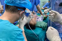 Bé trai 34 tháng tuổi viêm phổi do vỏ hướng dương rơi vào khí quản