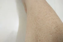 Cách khắc phục tình trạng 'da rắn' - bệnh thường gặp mùa lạnh