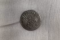 Ngậm đồng xu chơi, bé gái 10 tuổi vô tình nuốt vào thực quản