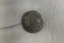 Ngậm đồng xu chơi, bé gái 10 tuổi vô tình nuốt vào thực quản