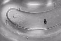 Hàng chục con giòi làm tổ trong tai người đàn ông 63 tuổi