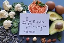 Top 10 loại thực phẩm giàu biotin nhất tốt cho sức khỏe
