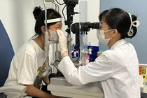 Nữ sinh 20 tuổi mắt 'khô như bà lão 70 tuổi' vì đeo kính áp tròng