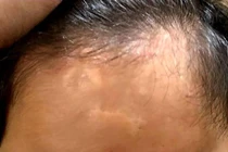 Vụ "gửi con chữa bệnh, nhận về tro cốt": Thêm 1 gia đình tố cáo