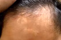 Vụ "gửi con chữa bệnh, nhận về tro cốt": Thêm 1 gia đình tố cáo