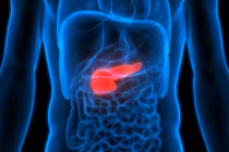 Đau bụng tưởng trào ngược dạ dày, hóa ra ung thư tuyến tụy