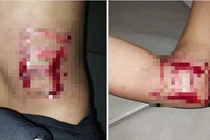 Thanh niên 29 tuổi bị sét đánh ngất ngay trong phòng ngủ