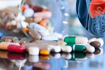 Tự mua thuốc đau xương khớp uống, người đàn ông bị sốc phản vệ độ 2