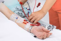 Dùng màng bụng thay màng lọc ở bệnh nhân chạy thận