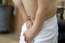 Đau vùng bìu ngại không nói, bé trai phải cắt bỏ tinh hoàn vì xoắn