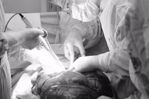 Tưởng bụng to do tăng cân, nam thanh niên không ngờ có khối u 8kg