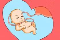 Nguyên nhân gây dây rốn quấn cổ thai nhi 