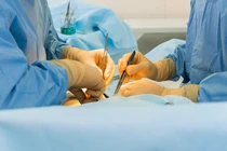 Loại bỏ khối u quái, kích thước lớn cho bệnh nhi 8 tháng tuổi