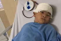 Sau 5 năm cậu bé mạnh mẽ mắc Moyamoya vẫn khỏe mạnh bình thường