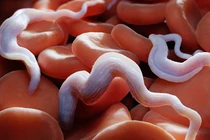 Ho nhiều từng cơn, khó thở... vào viện phát hiện viêm phổi do ký sinh trùng