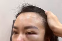 Hà Nội: Vợ bị chồng cũ “bắt cóc” đánh đập dã man