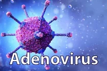 Cách phòng tránh và chữa trị Adenovirus