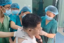 Lấy cây gỗ đâm xuyên từ trước ngực ra sau lưng, thủng phổi