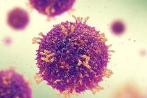 "Báo động đỏ" dịch sởi có thể đe dọa toàn cầu