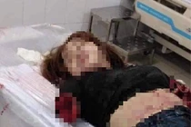 Bắt giam 4 tháng người chồng chém đứt lìa 2 cánh tay vợ