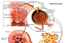 Suy thượng thận do dùng thuốc corticoid chữa dị ứng, viêm khớp