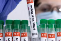 Người mắc bệnh Đậu mùa khỉ đầu tiên tại Việt Nam là nữ