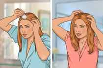 5 cách tự nhiên giúp kích thích tóc mọc nhanh và dày dặn