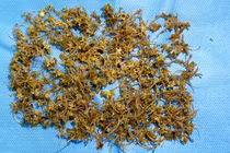 Nam bệnh nhân bị tắc ruột do nuốt hàng ngàn mảnh xương rắn