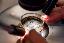 Phát hiện vi nhựa trong dịch nang buồng trứng 