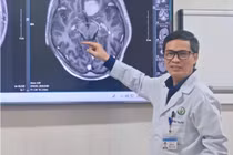 Phẫu thuật nội soi u não qua cung mày, phục hồi nhanh