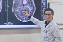 Phẫu thuật nội soi u não qua cung mày, phục hồi nhanh