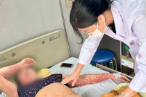 Người phụ nữ mặt biến dạng, toàn thân ban đỏ do dị ứng thuốc