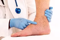 Chế độ dinh dưỡng cho người bệnh huyết khối tĩnh mạch sâu