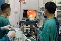 Cắt bỏ khối u cơ thực quản đường miệng không cần phẫu thuật