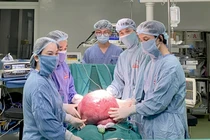 Uống thuốc nam trị u buồng trứng, người phụ nữ gánh khối u 15 kg 