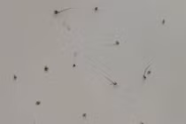 Rận bám chi chít trên mi mắt người phụ nữ 46 tuổi