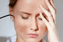 Dấu hiệu trên da "tố cáo" bạn đang căng thẳng quá mức