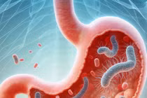 "Điểm" loạt thực phẩm hỗ trợ kiểm soát vi khuẩn HP trong dạ dày