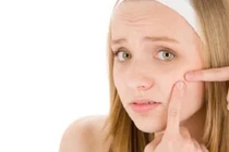 Tips chăm sóc da đúng cách cho tuổi dậy thì