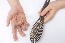 Rụng tóc bất thường đừng chủ quan, có thể dấu hiệu cảnh báo một số bệnh 