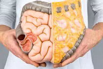 Cách "đào thải" mỡ nội tạng ở người trung niên