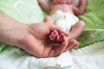 Cấp cứu thành công trẻ đẻ rơi tại nhà non tháng, bị suy hô hấp