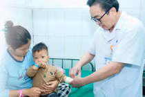 Điều trị bỏng bằng mẹo dân gian: hiểm họa khôn lường