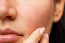 8 thói quen xấu hàng ngày khiến da khô