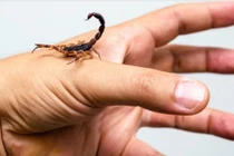 Thiếu nữ 16 tuổi bị sốc phản vệ do bọ cạp cắn