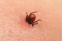 Người phụ nữ 69 tuổi nguy kịch tính mạng vì bị mò đốt